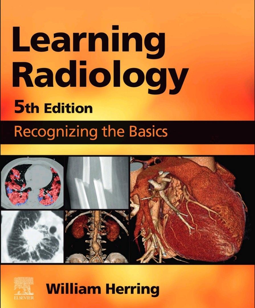 Learning Radiology by William Herring 5th edition (Category: Textbooks) located in Manila. Submitted by declutter.p (Listing ID 1278790342, Image 1). Description: Original pdf copy. File transfer via Tg once paid Dr. William Herring’s Learning Radiology: Recognizing the Basics, 5th Edition, remains the leading introductory radiology text for medical students and others who are required to read and interpret common radiologic images. Using an easy