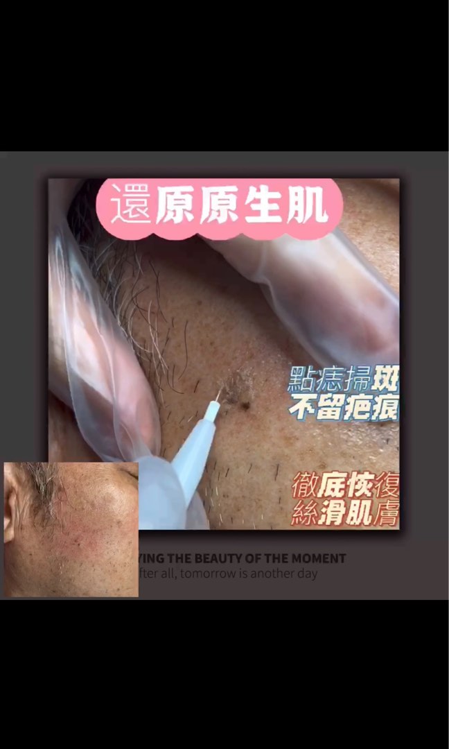 （分類：）位於 。 由 skingeneo62082087 提交（商品編號 1265167697，圖片 1）。簡介： 。