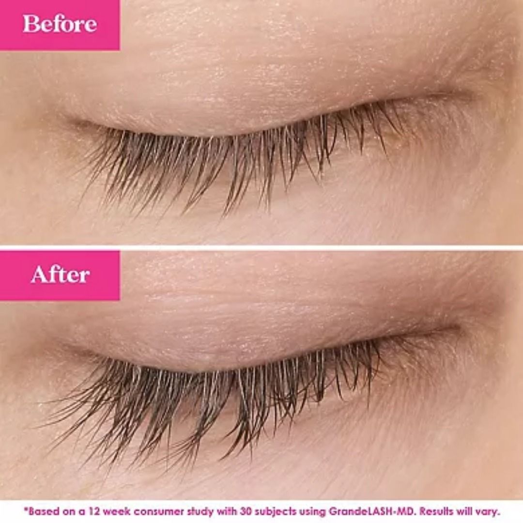 GRANDE COSMETICS Lash Repair Kit (Category: Makeup) located in Quezon City. Submitted by happyfactoryph (Listing ID 1149591997, Image 2). Description: GRANDE COSMETICS Lash Repair Kit – P2090 (from P3500) ⁣ Product Details: Did you know you naturally lose 1-2 lashes daily? Give them the extra care they need with this must-have lash fixer upper. GrandeREPAIR is an invisible leave-in conditioner that helps to protect, strengthen, fortify, and softe