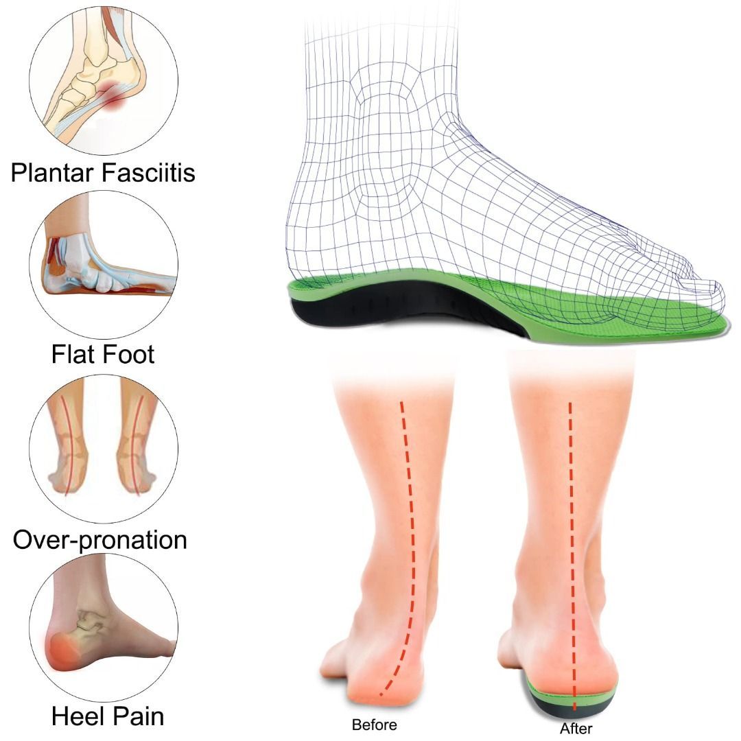 Mens insoles for plantar fasciitis sales