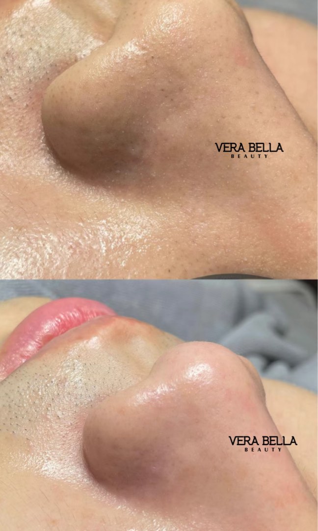 (分類:)位於 。 由 vera_bella_beauty 提交(商品編號 1330457418,圖片 1)。簡介: 。