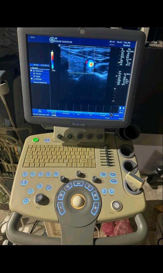 Ultrasound Ge logic c5 With linear probe only, Health & Nutrition