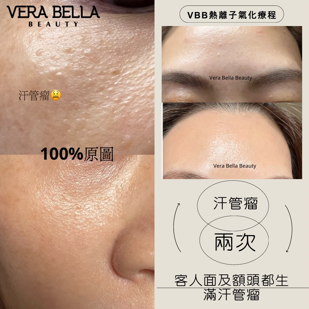 （分類：）位於 。 由 vera_bella_beauty 提交（商品編號 1329940378，圖片 1）。簡介： 。