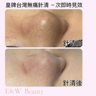 （分類：）位於 。 由 Wai88 提交（商品編號 1337425178，圖片 1）。簡介： 。