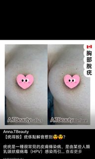 （分類：）位於 。 由 annatbeauty 提交（商品編號 1342886780，圖片 1）。簡介： 。