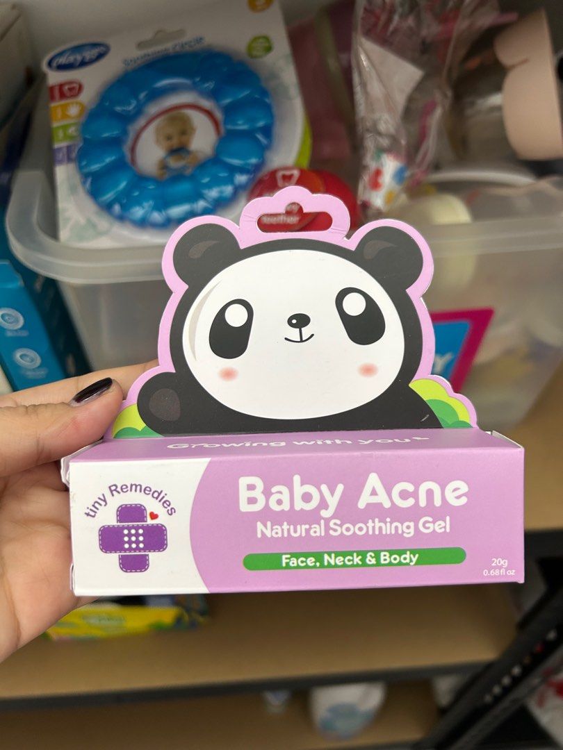 tinybuds baby acne gel (Category: Baby Toiletries & Grooming) located in Malabon City. Submitted by monstershaaa (Listing ID 1344158171, Image 1). Description: brandnew & sealed rfs : baby using other creams .