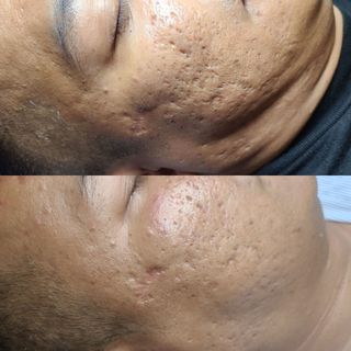 (Category: ) located in . Submitted by kbeautyhouse (Listing ID 1340625988, Image 1). Description: .