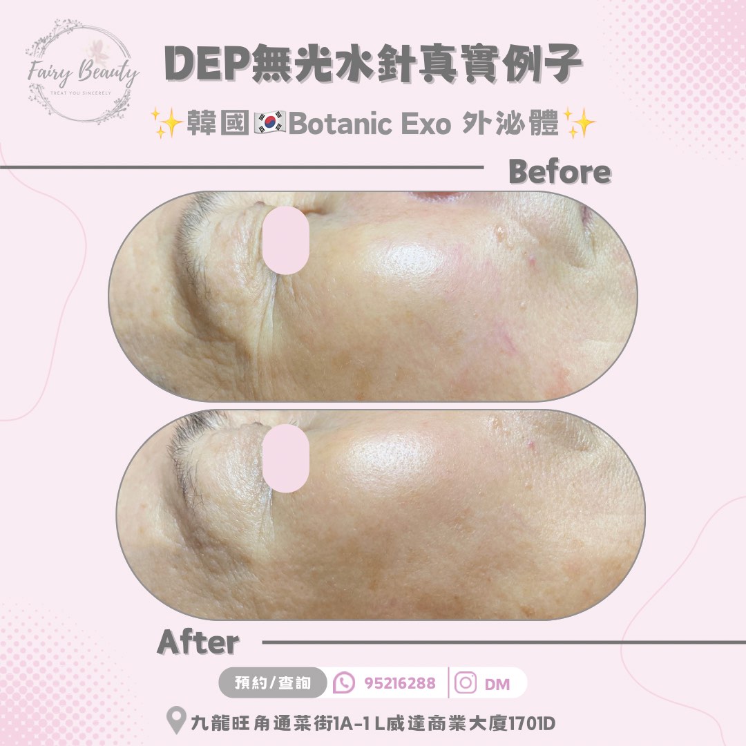 （分類：）位於 。 由 fairy__beauty 提交（商品編號 1290501364，圖片 1）。簡介： 。