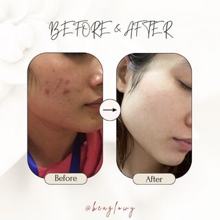 （分類：）位於 。 由 beaglowy 提交（商品編號 1292567446，圖片 1）。簡介： 。