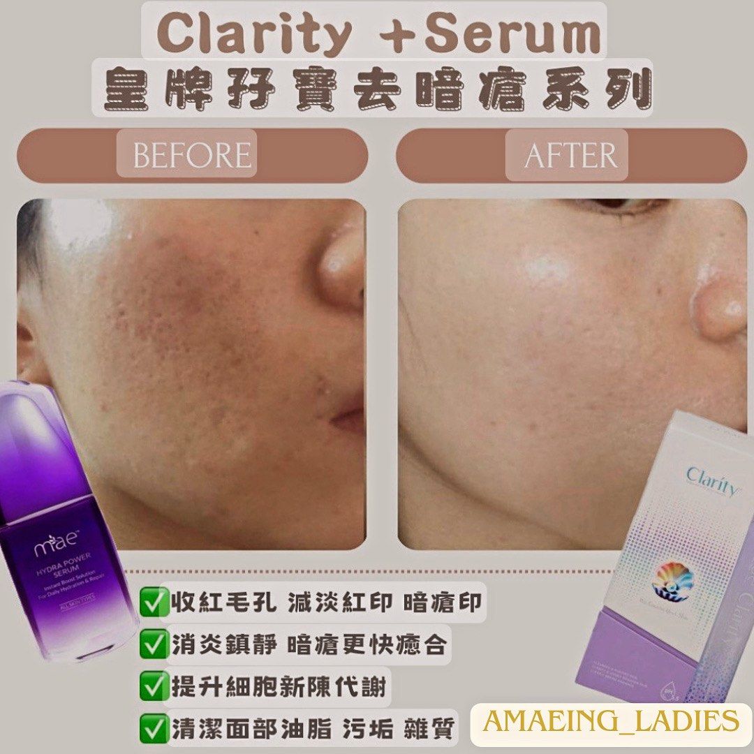 MAE clarity 面膜or 精華, 美容＆個人護理, 健康及美容- 皮膚護理, 面部- 面部護理- Carousell