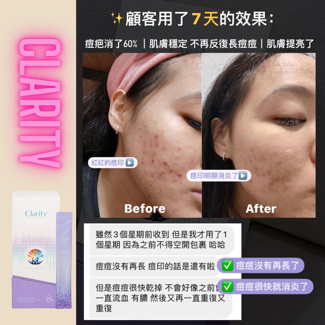 MAE clarity 清潔面膜, 美容＆個人護理, 健康及美容- 皮膚護理, 面部- 面部護理- Carousell