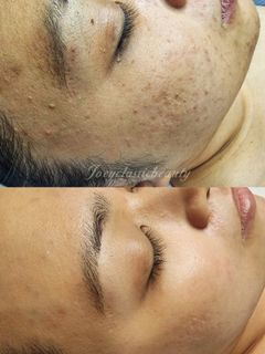 (Category: ) located in . Submitted by Joeyclassicbeauty (Listing ID 1074040701, Image 1). Description: .