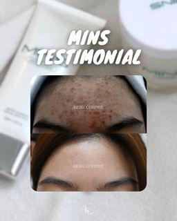 （分類：）位於 。 由 vickyhsu__ 提交（商品編號 1298025521，圖片 1）。簡介： 。