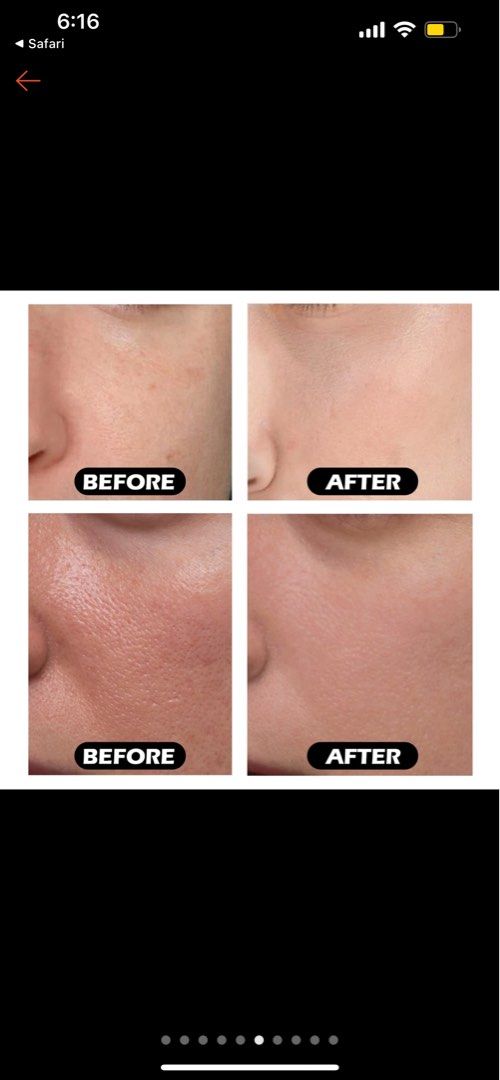 Facial - Micro needling - BB glow Clementi (Category: Beauty & Health Services) located in Singapore. Submitted by tenshimakeup.sg (Listing ID 1296777615, Image 3). Description: 📌BASIC FACIAL : 48$ (7 step) ( 45 minutes) Double wash - Scrub-steamer-extraction- massage face -mask 📌HYDRATING FACIAL: 60$( 8steps)( 70 minutes) - Double clean- scrub-steamer machine - aqua peel -hydrating ( with machine ) - massage face - mask - biological light mach