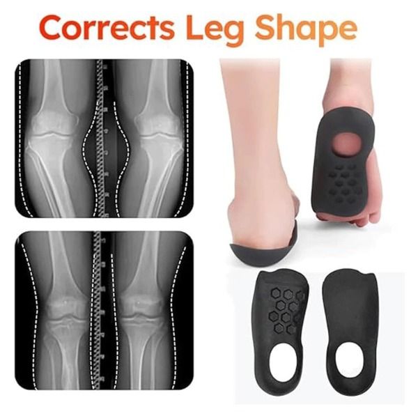 Orthotics Arch Support Insoles High Arch Support Flat Feet Walking Exercising Bunion Corrector Splints
