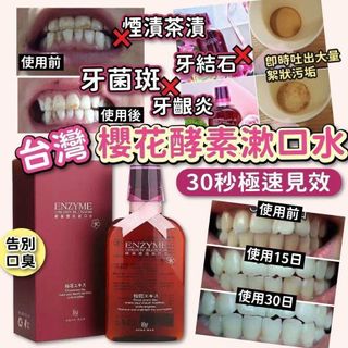 現貨💕 台灣🇹🇼櫻花漱口水(350ml)62939565011713110