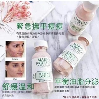 (元朗交收）Mario Badescu 皇牌暗瘡粉刺水64212823107457110
