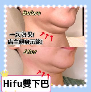 （分類：）位於 。 由 belle_debeaute 提交（商品編號 1296891490，圖片 1）。簡介： 。