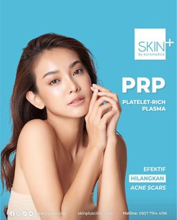 (Kategori: ) berada di . Dikirim oleh prelovedbytiaa (ID iklan 1303221791, Gambar 1). Deskripsi: .