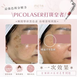 （分類：）位於 。 由 metabeautylab 提交（商品編號 1303711852，圖片 1）。簡介： 。