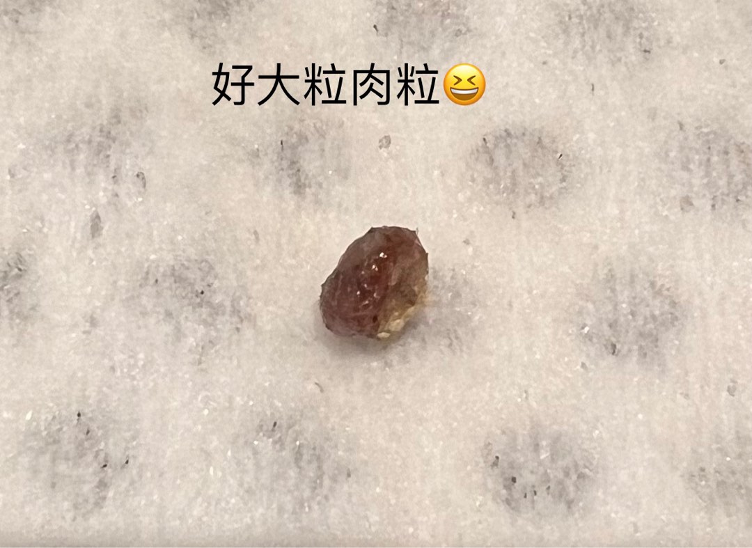 （分類：）位於 。 由 skingeneo62082087 提交（商品編號 1301195304，圖片 1）。簡介： 。
