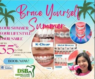 Teeth Braces Best Discounted Price