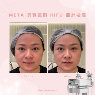 （分類：）位於 。 由 metabeautylab 提交（商品編號 1272824282，圖片 1）。簡介： 。