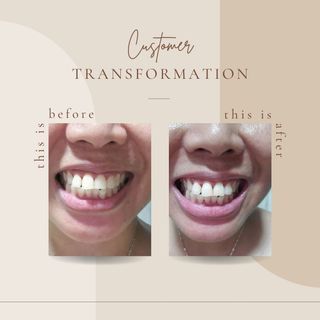Whitening toothpaste | AP24