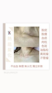 （分類：）位於 。 由 s_girlbeauty 提交（商品編號 1306803536，圖片 1）。簡介： 。