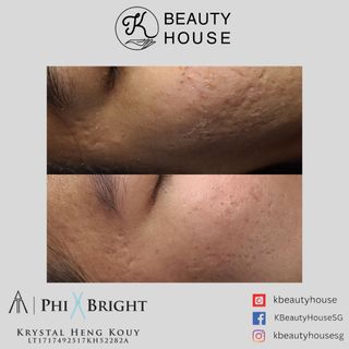 (Category: ) located in . Submitted by kbeautyhouse (Listing ID 1307190378, Image 1). Description: .