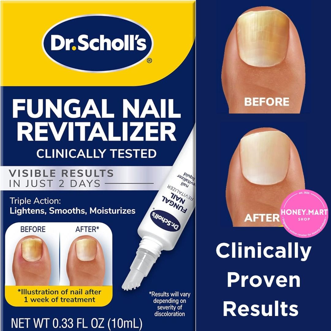 Dr scholl's fungal nail revitalizer hot sale