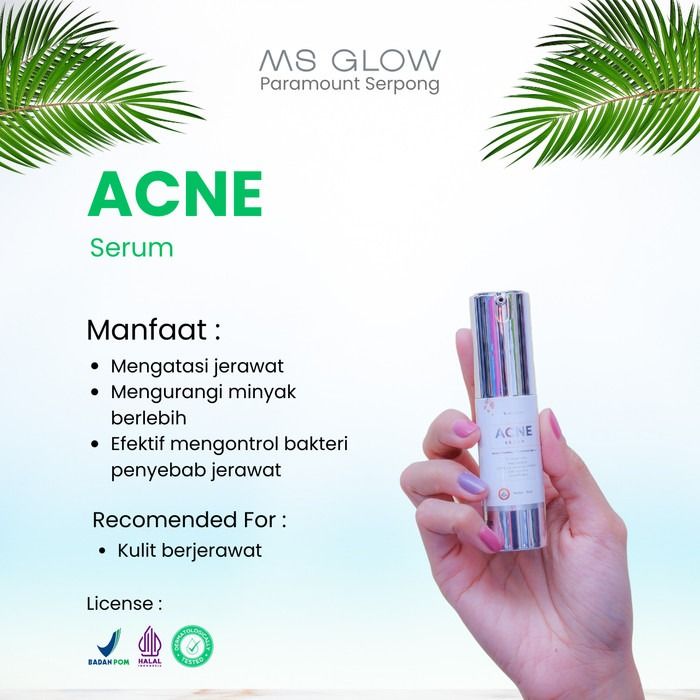 Serum acne ms glow sale