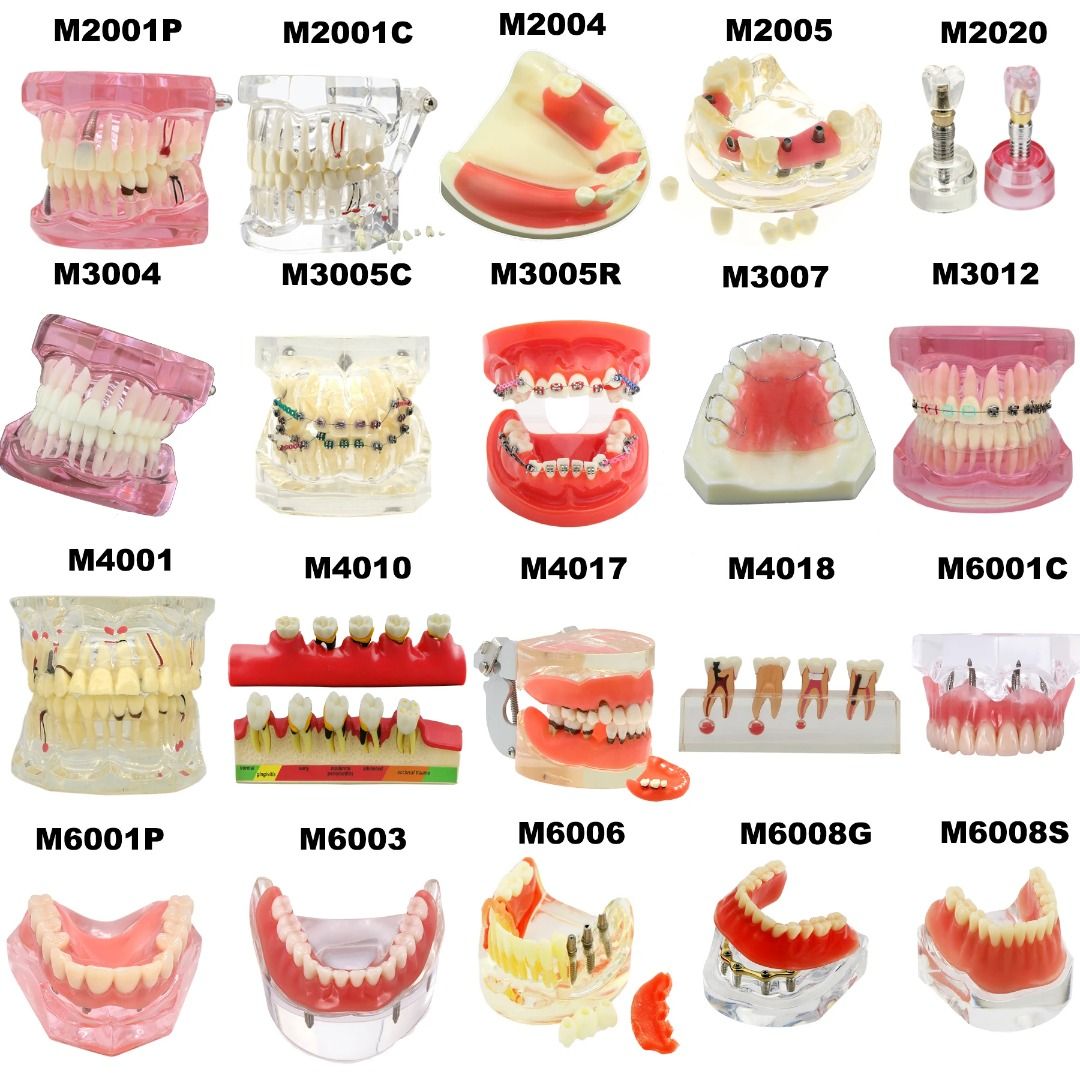 Dental Teeth Model Dental Teaching Models Implant Model Removable ...