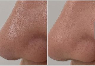 (Category: ) located in . Submitted by institucarebalance (Listing ID 1317756146, Image 1). Description: .