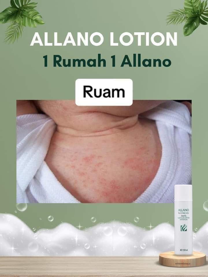 ORIGINAL ALLANO FROM AMWAY, Beauty & Personal Care, Sanitisers ...