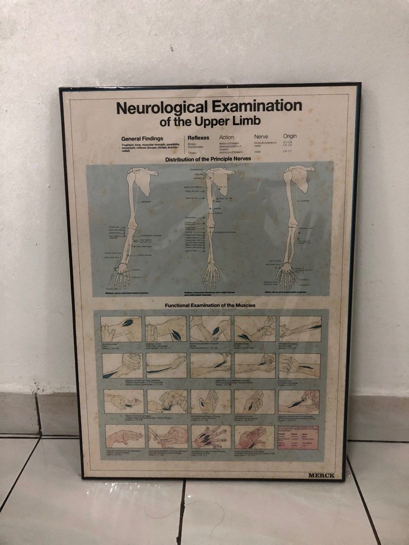 Vintage Anatomy Poster with wood frame, Hobbies & Toys, Collectibles