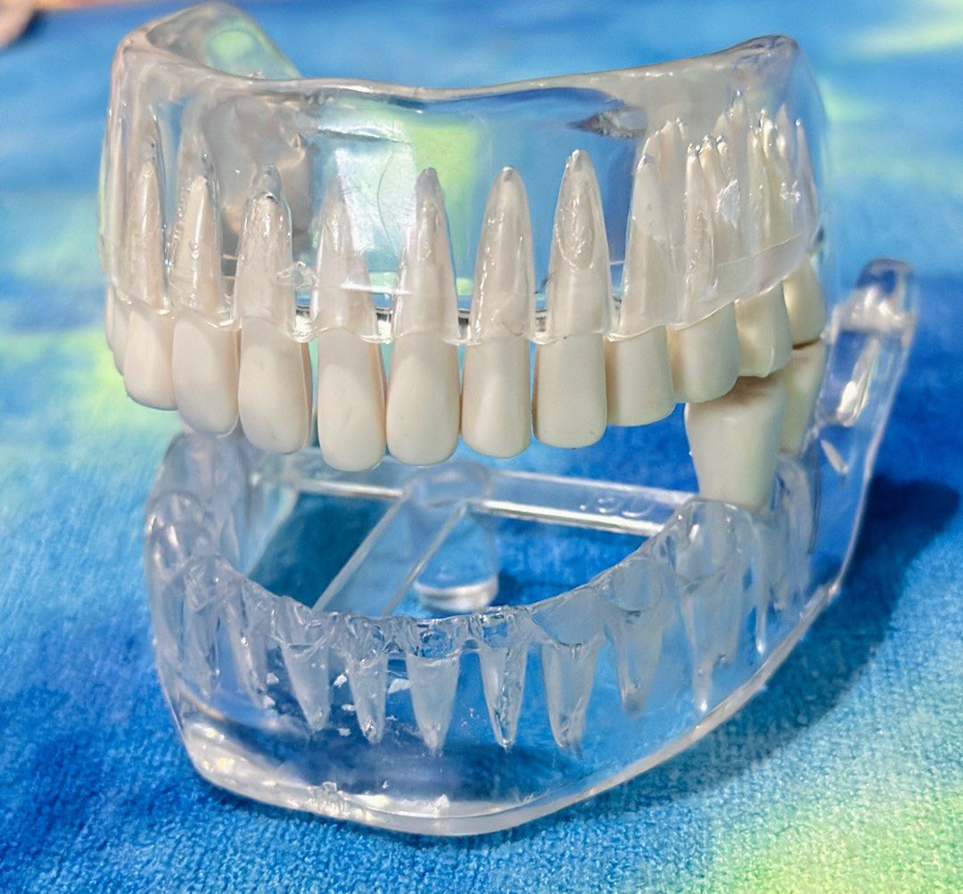 Dental Model Teeth Demonstration (Category: Medical Supplies & Tools) located in General Santos City (Dadiangas). Submitted by toysville888 (Listing ID 1323478849, Image 1). Description: Dental Model Teeth Demonstration sold as is.. incomplete teeth i do combine shipment to save on shipping cost.. 100 lng po sf from here sa mindanao, 5-7days arrival. pay now ship now. gcash 12noon cut off time po.