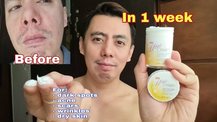 Magic Cream for Acne Pimples Stretchmarks and Darkspots (Category: Face Care) located in Quezon City. Submitted by sofia_1225 (Listing ID 1349465600, Image 2). Description: Good for 1 month use. See the difference in just 7 days! Magic cream is hydroquinone and mercury free. ❤️ Superbrands approve!! Php 499 only Before 550 West Triangle Q.C area 09152632728.