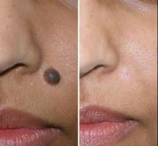 (Category: ) located in . Submitted by institutcarebalance.223 (Listing ID 1398740303, Image 1). Description: .