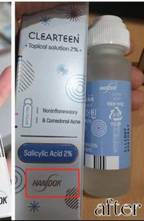 ✅包郵/可面交✅現貨-韓國藥房熱賣 HANDOK Acne Clearteen 水楊酸祛痘抗粉刺抗痘水 – 30ml64237119667459110