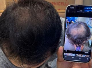 HeBe 防脫髮洗頭水 （東京直送）shampoo 英國醫學美容級科技64242312512514110