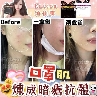 💥包SF💥現貨💥過千好評賣家💥[ 5片] 日本 𝐅𝐚𝐭𝐞𝐫𝐚神仙膜64242312163458110