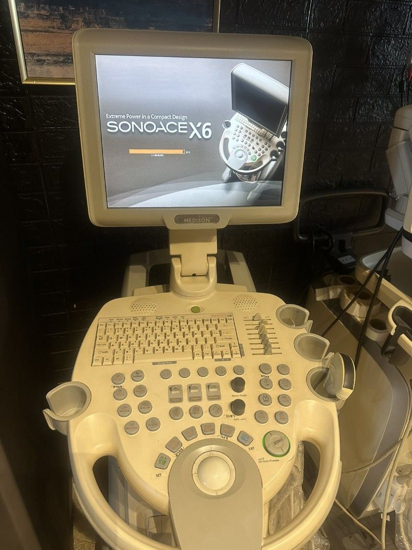 Ultrasound Machine Samsung X6 (Category: Medical Supplies & Tools) located in Angeles City. Submitted by ryainramos (Listing ID 1400042075, Image 3). Description: 2 probes convex linear.