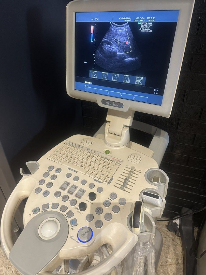 Ultrasound Machine Samsung X6 (Category: Medical Supplies & Tools) located in Angeles City. Submitted by ryainramos (Listing ID 1400042075, Image 1). Description: 2 probes convex linear.