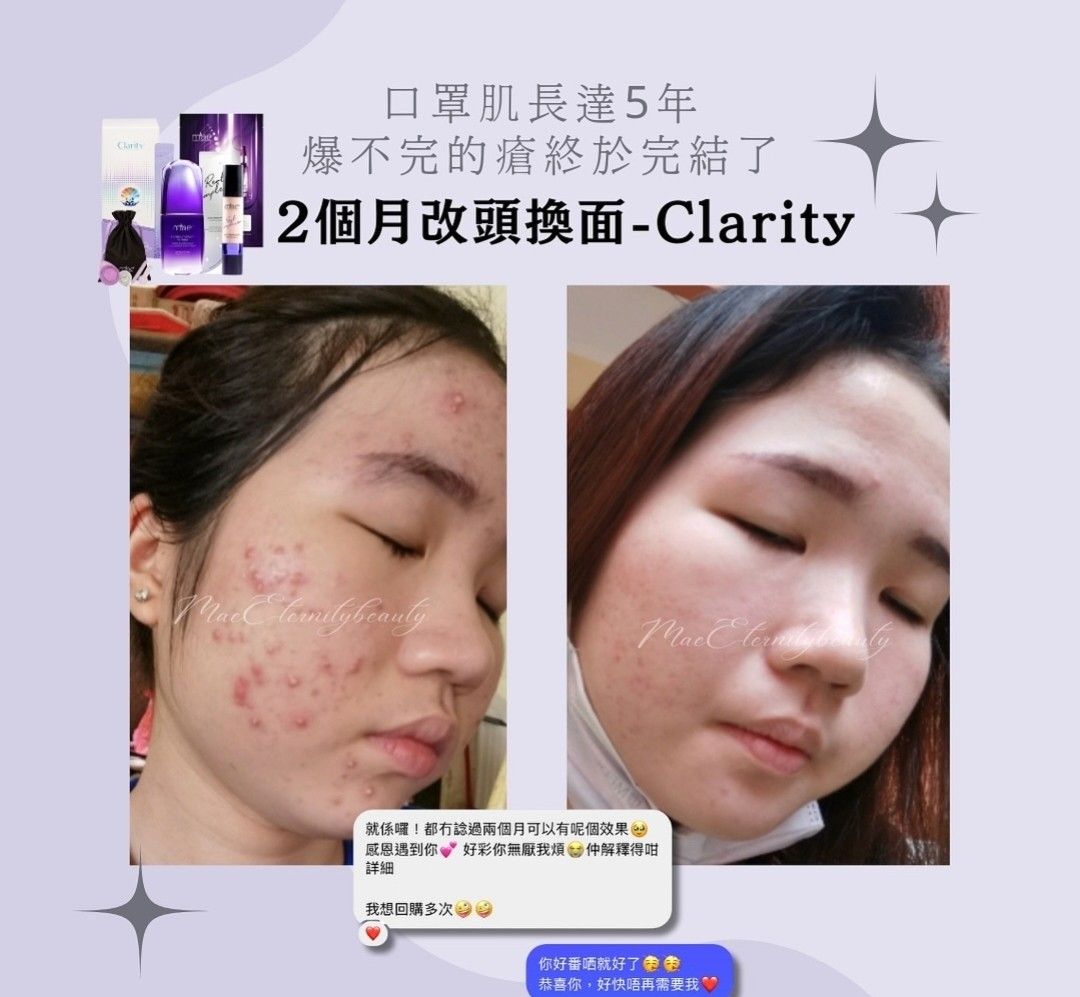 Clarity 7天試用裝，包面膜 掃｜洗面只係做清潔，養皮膚先係做保養，唔調好皮膚ph值，搽幾貴嘅精華都無用！｜下單後根據皮膚狀態教你獨家用法，你嘅皮膚我負責｜真用家，真代理，永久跟進｜佛系店主，試完唔啱絕對唔會硬銷，隨心買｜可面交，順便睇無化妝之下嘅效果｜包  ...