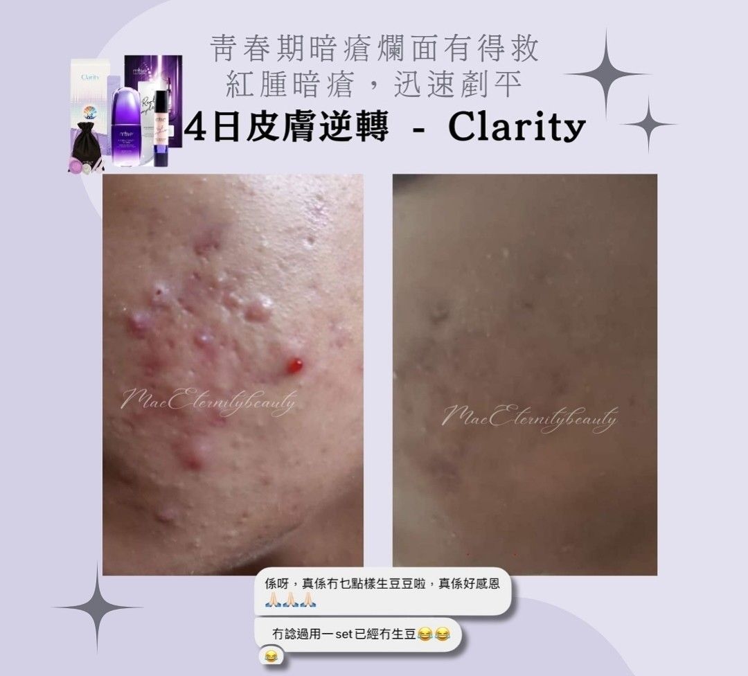 Clarity 7天試用裝，包面膜 掃｜洗面只係做清潔，養皮膚先係做保養，唔調好皮膚ph值，搽幾貴嘅精華都無用！｜下單後根據皮膚狀態教你獨家用法，你嘅皮膚我負責｜真用家，真代理，永久跟進｜佛系店主，試完唔啱絕對唔會硬銷，隨心買｜可面交，順便睇無化妝之下嘅效果｜包  ...
