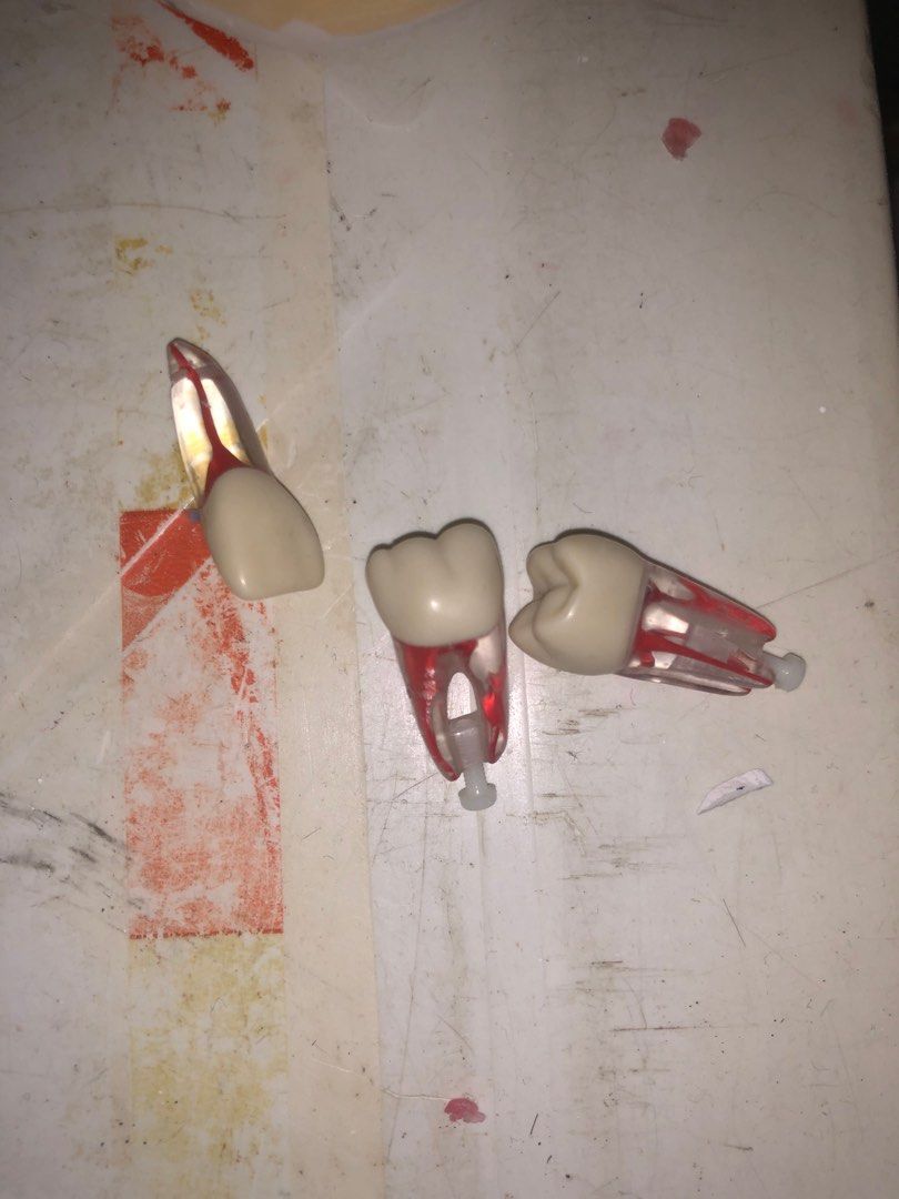 Jchenny endo tooth specimen (Category: Medical Supplies & Tools) located in Manila. Submitted by shopdenisse (Listing ID 1407085237, Image 1). Description: 11, 46, 26.