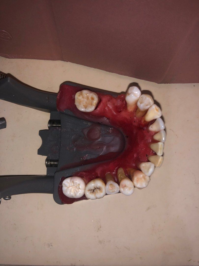 Natural teeth with articulator (Category: Medical Supplies & Tools) located in Manila. Submitted by shopdenisse (Listing ID 1407085748, Image 1). Description: Orig price 3000.