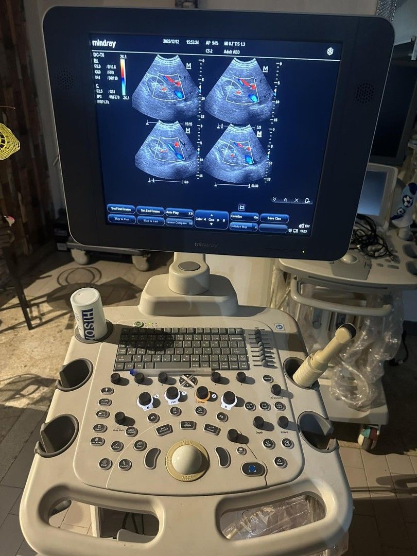 Ultrasound Machine (Category: Medical Supplies & Tools) located in Angeles City. Submitted by ryainramos (Listing ID 1409330898, Image 3). Description: Mindray T6 2 probes Convex Transv.