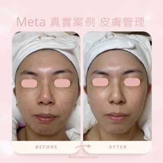 （分類：）位於 。 由 metabeautylab 提交（商品編號 1274537709，圖片 1）。簡介： 。